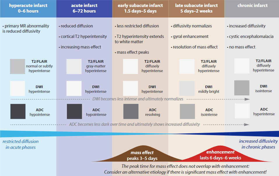 Evolution of infarction MRI.png