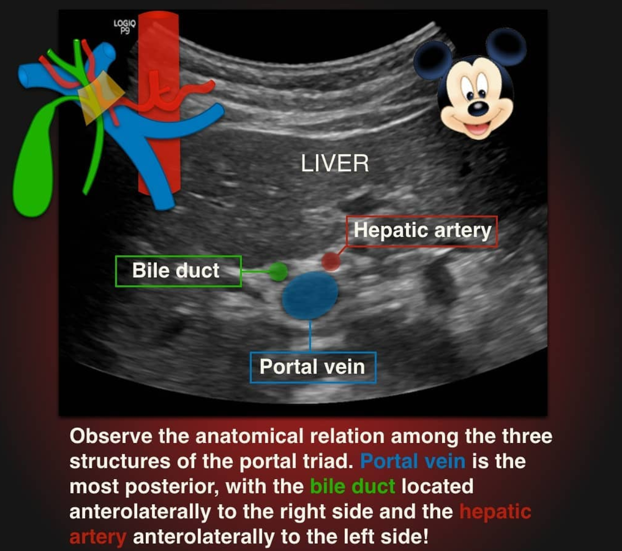 Mickey Mouse sign.png