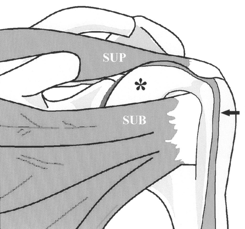 rotator interval.png